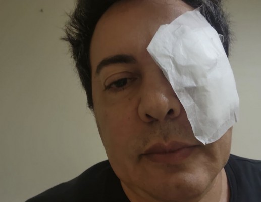 Cantor sergipano Daniel Diau se machuca em treino de musculação | 93  Notícias
