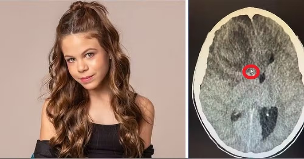 Millena Brandão tinha 11 anos; ao lado foto do exame onde seta do mouse circundada em vermelho mostra mancha suspeita de ser um tumor no cérebro da atriz, segundo a família — Foto: Reprodução/Divulgação