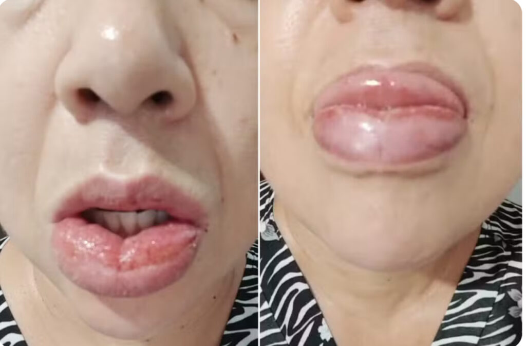 Mais de 1,2 mil pessoas relatam reações adversas após uso de pasta de dente Colgate Clean Mint
