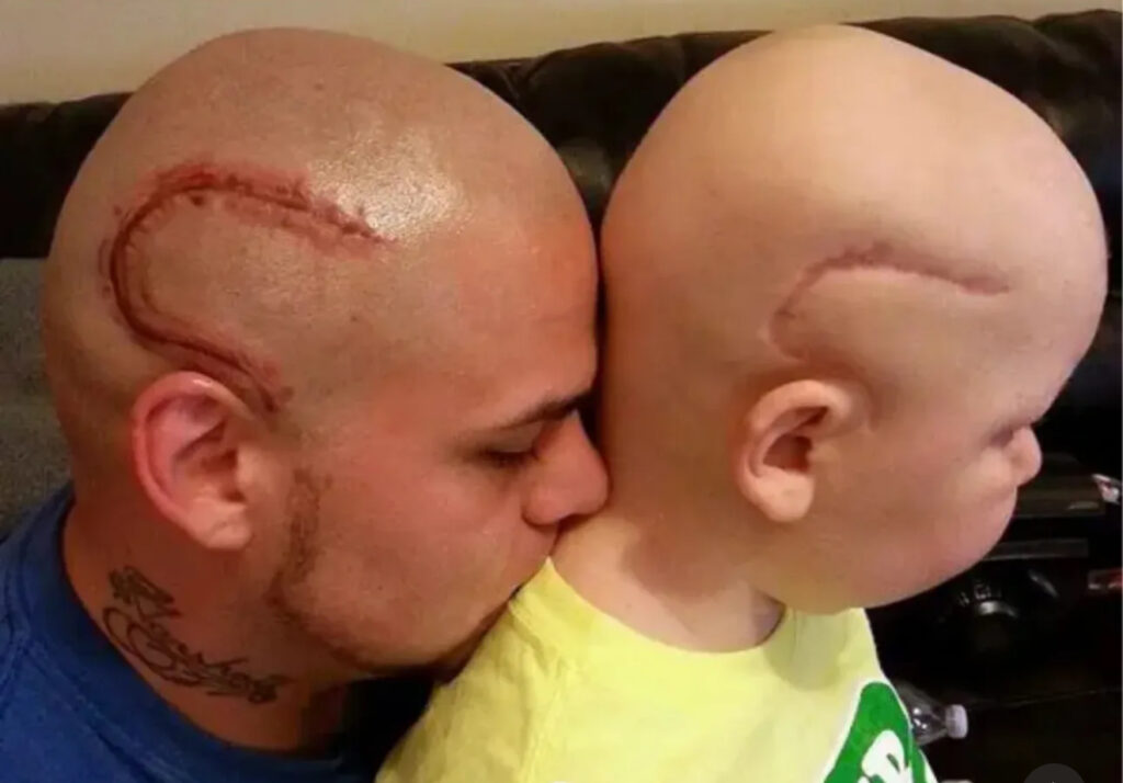 Pai tatua cicatriz do filho após cirurgia contra câncer e emociona o mundo