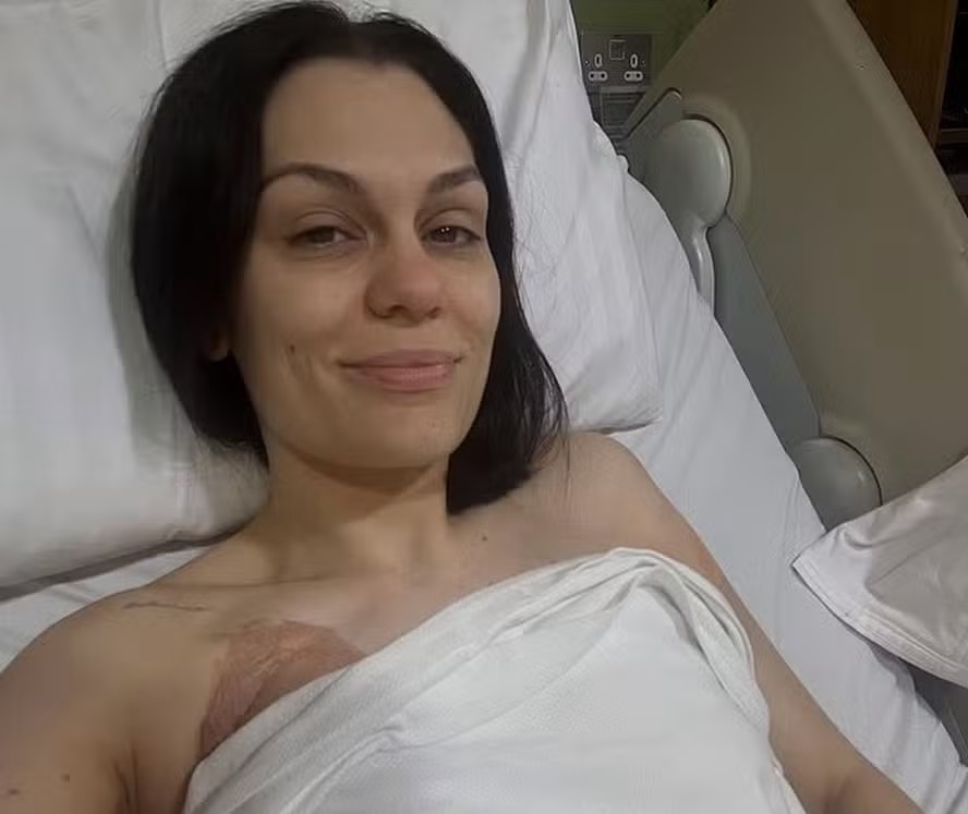 Cantora Jessie J é hospitalizada com infecção e líquido nos pulmões após cirurgia de câncer