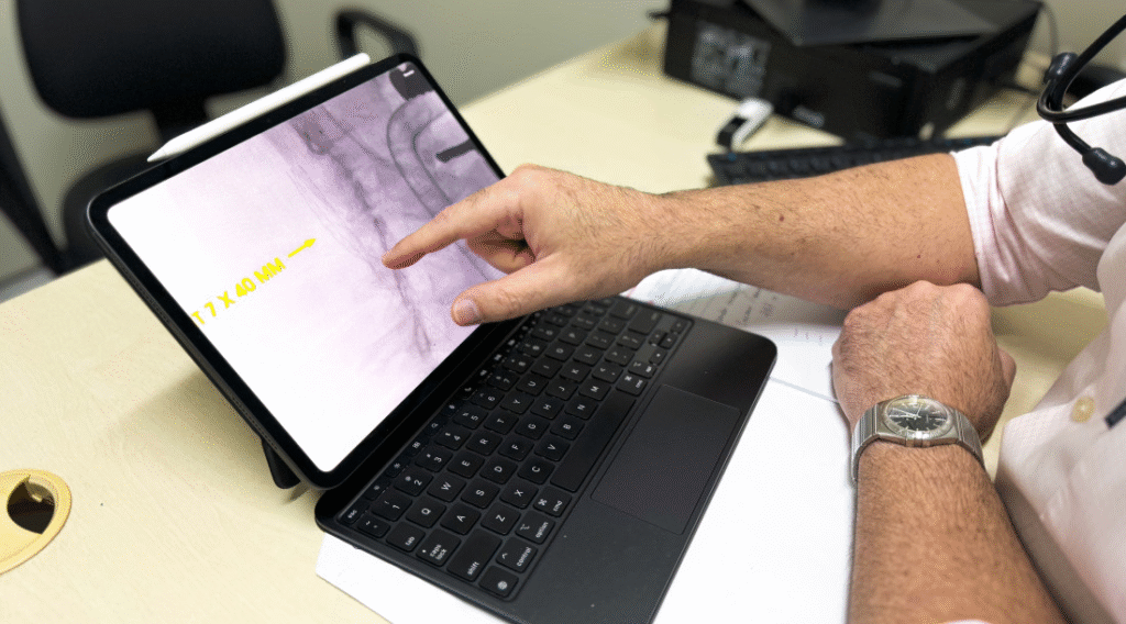 Ipesaúde fortalece Serviço de Angiologia com ampliação de atendimentos a doenças circulatórias