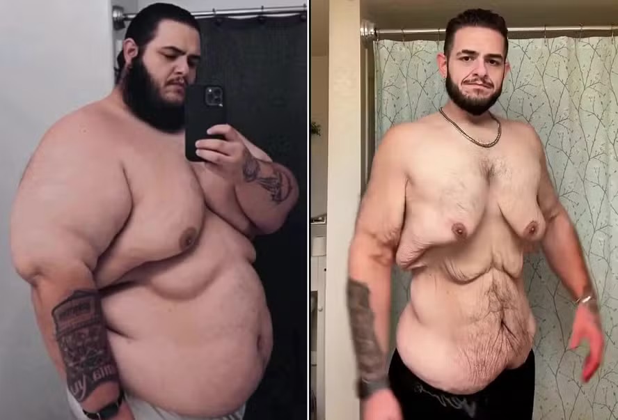 Influenciador Garrett Olson perde 150 quilos e inspira seguidores