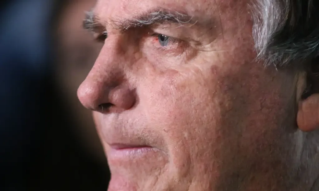 Bolsonaro passa por novo bloqueio do nervo frênico após crise de soluços