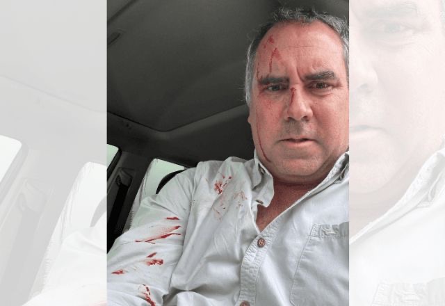 Ataque no Peru: Pré-candidato à Presidência Rafael Belaúnde Llosa sofre atentado a tiros