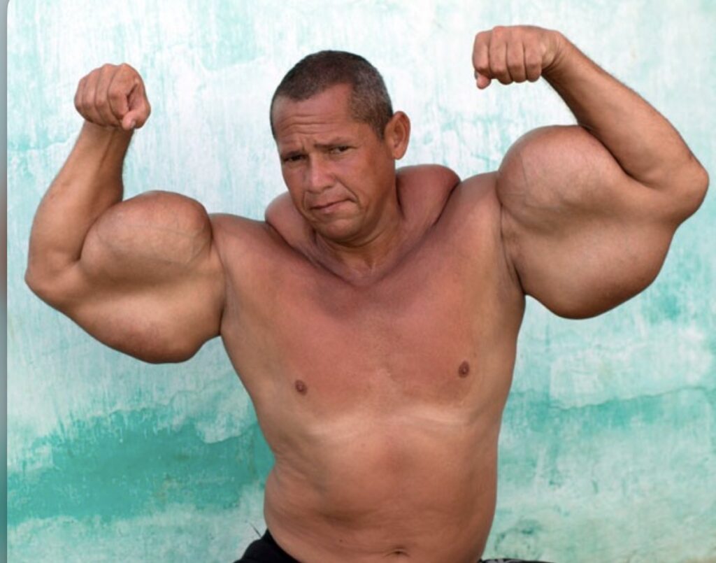 Morre Arlindo Montanha, o “Popeye Brasileiro”, aos 51 anos