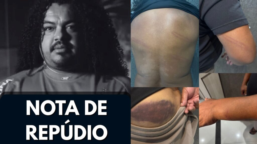 Perdigão, ídolo do Internacional, denuncia agressão de policial militar após jogo no Paraná