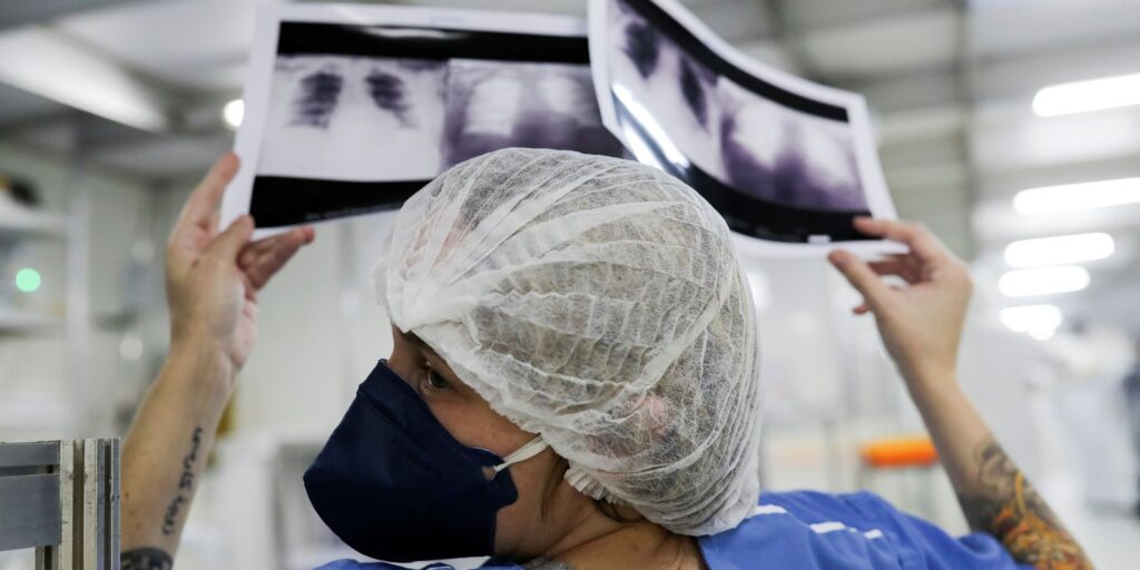 Estudo projeta 781 mil novos casos de câncer por ano no Brasil entre 2026 e 2028