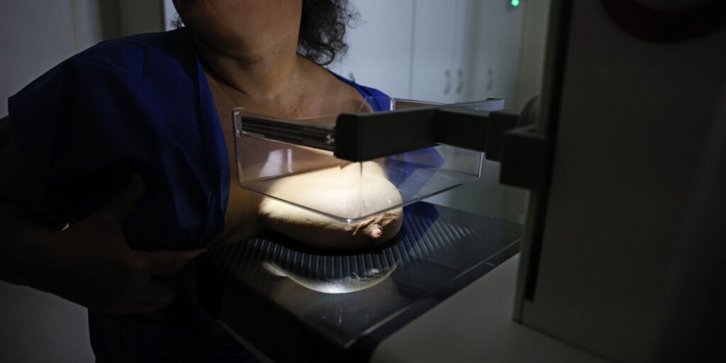 Pesquisa Vigitel aponta que 91,9% das mulheres de 50 a 69 anos já fizeram mamografia
