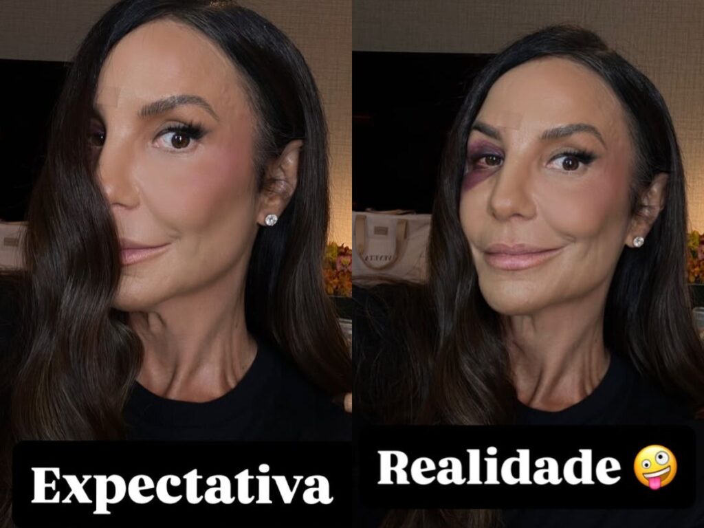 Ivete Sangalo retorna aos palcos em São Paulo após acidente doméstico e destaca fé