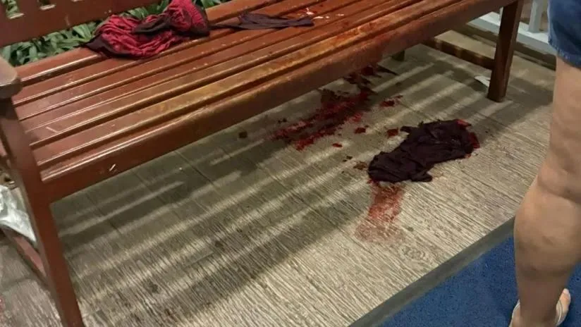 Discussão em condomínio de Aracaju termina com casal morto e moradores feridos