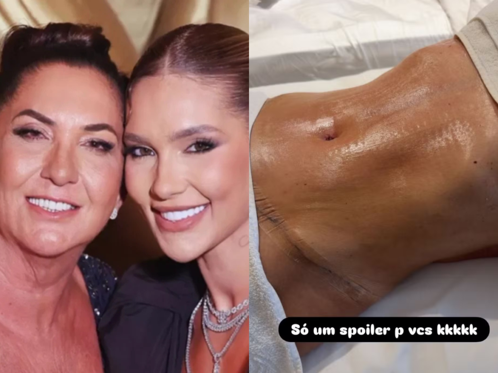Mãe de Virginia mostra evolução do corpo 30 dias após cirurgias e faz sessão de bronzeamento