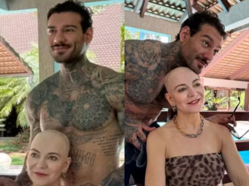 Karina Lucco diz que falhas no couro cabeludo continuam visíveis mesmo após raspar a cabeça