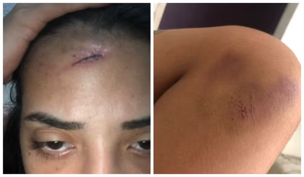 “Ele já me deu paulada”: Jovem que esfaqueou namorado em Maceió relata tortura e perseguição