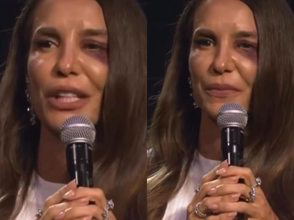 Ivete Sangalo passa por cirurgia de 7 horas e cancela agenda de shows para recuperação