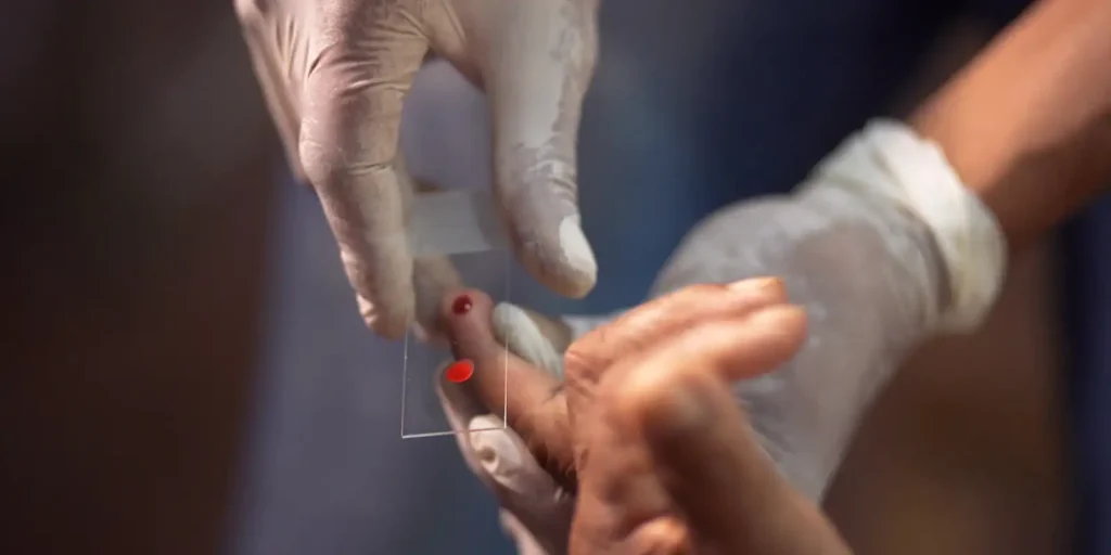 SUS inicia uso de tafenoquina pediátrica para tratar malária em crianças