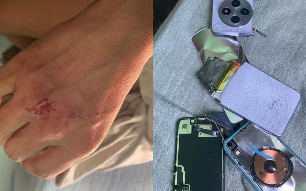 Jovem de 24 anos denuncia agressão e destruição de imóvel por ex-companheiro em Aracaju.