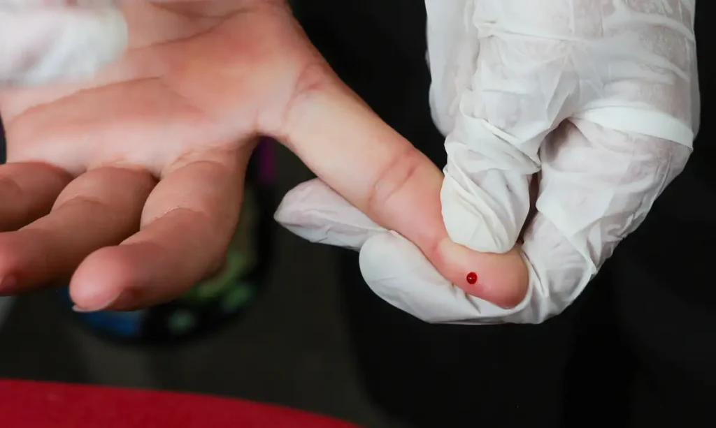 SUS passa a oferecer teste rápido NS1 para diagnóstico da dengue