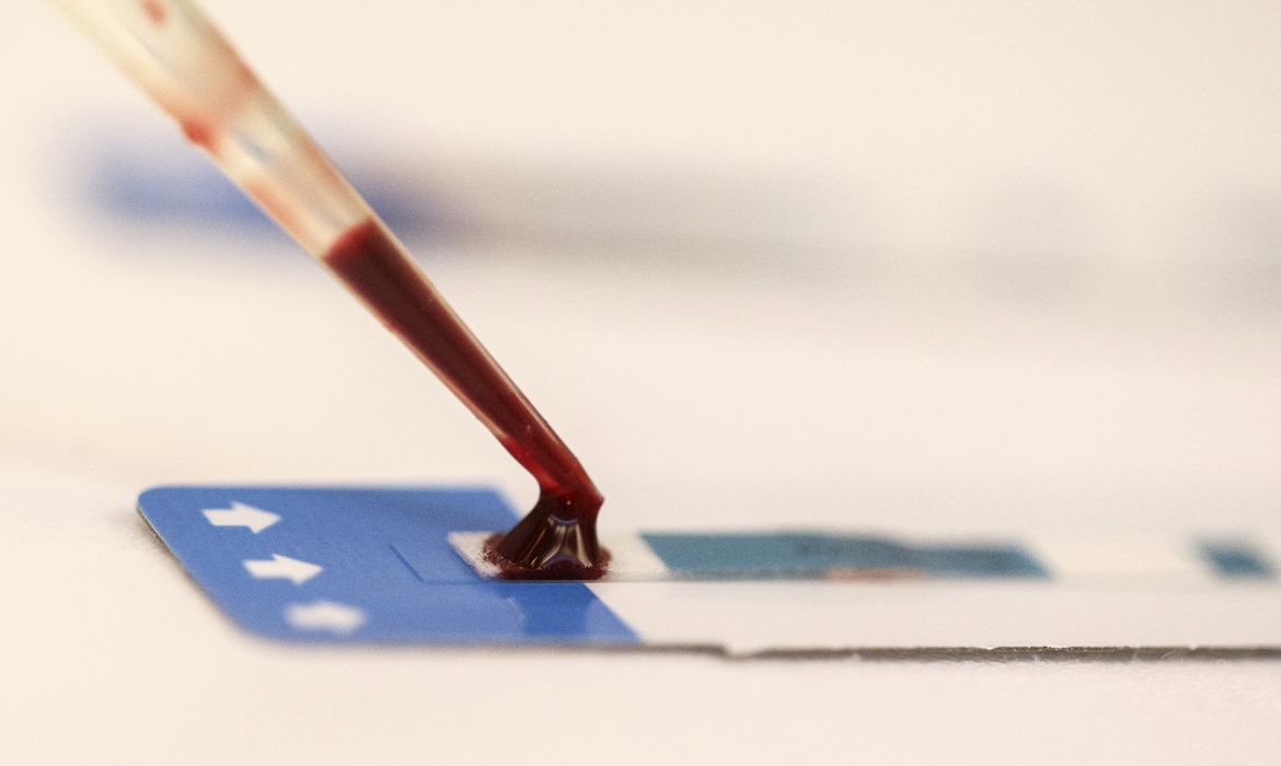 Fiocruz lança estudo para ampliar prevenção do HIV entre jovens em periferias