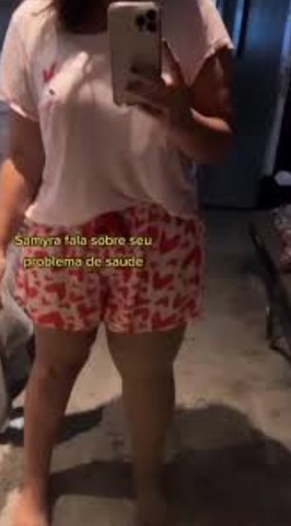 Samyra Show esclarece diagnóstico de linfedema e alerta para diferenças entre as condições