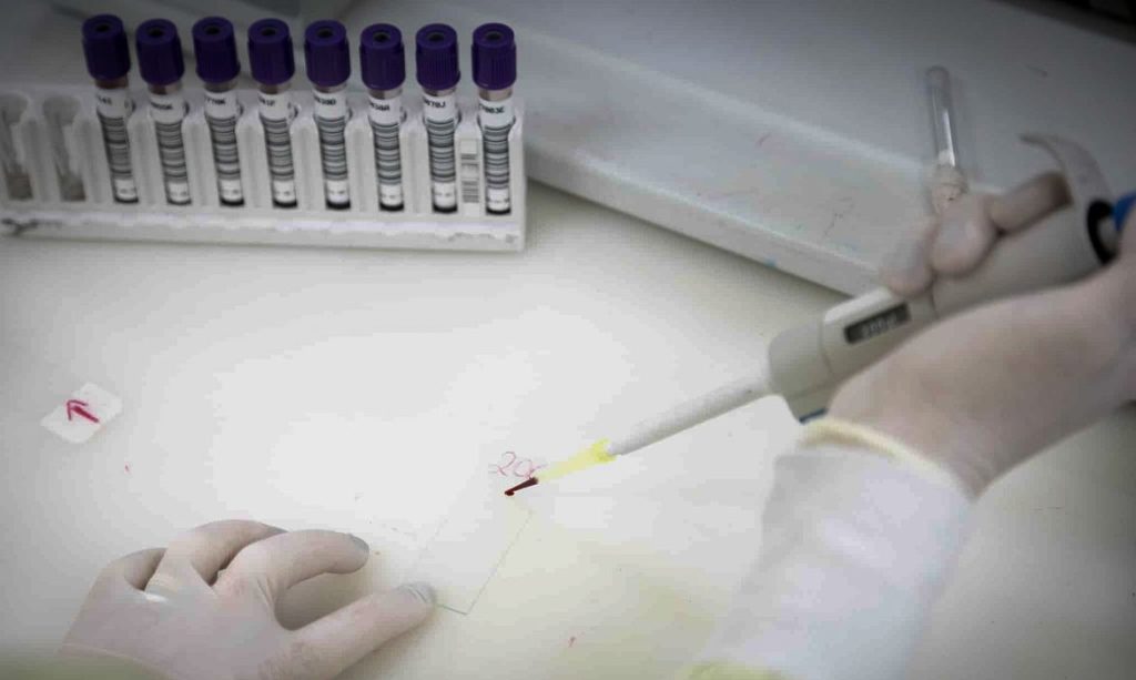 Exames descartam ebola em imigrante da República Democrática do Congo