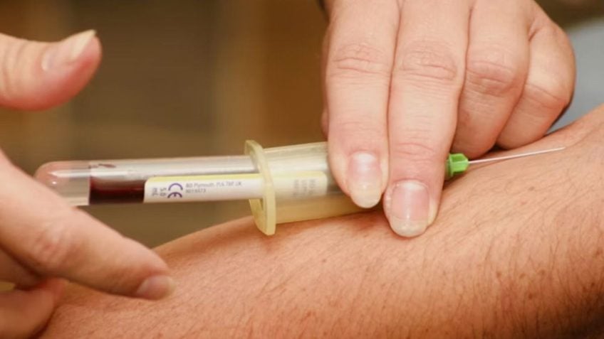 Exame de sangue detecta 4 vezes mais casos de câncer em estudo do NHS