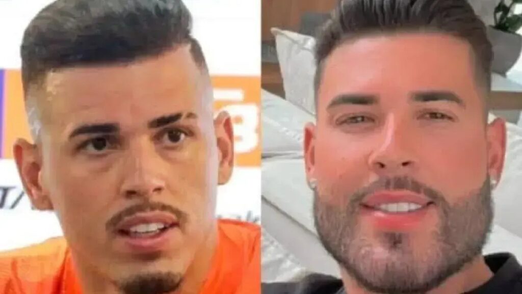 Harmonização Facial: O Que Você Precisa Saber Sobre o Procedimento de Vini Jr.