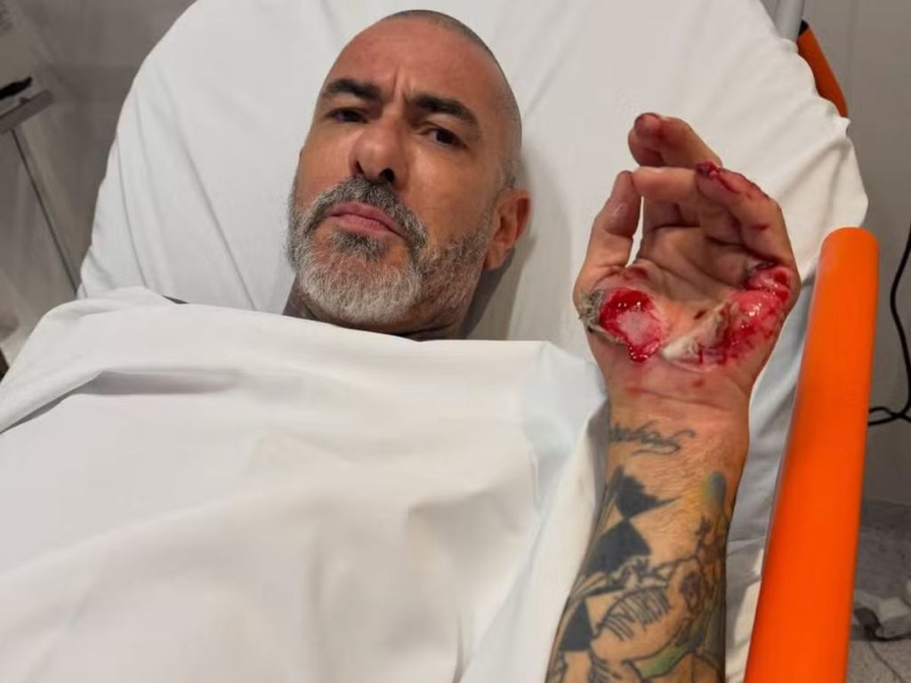Henrique Fogaça revela feridas de acidente e roubo de aliança em hospital