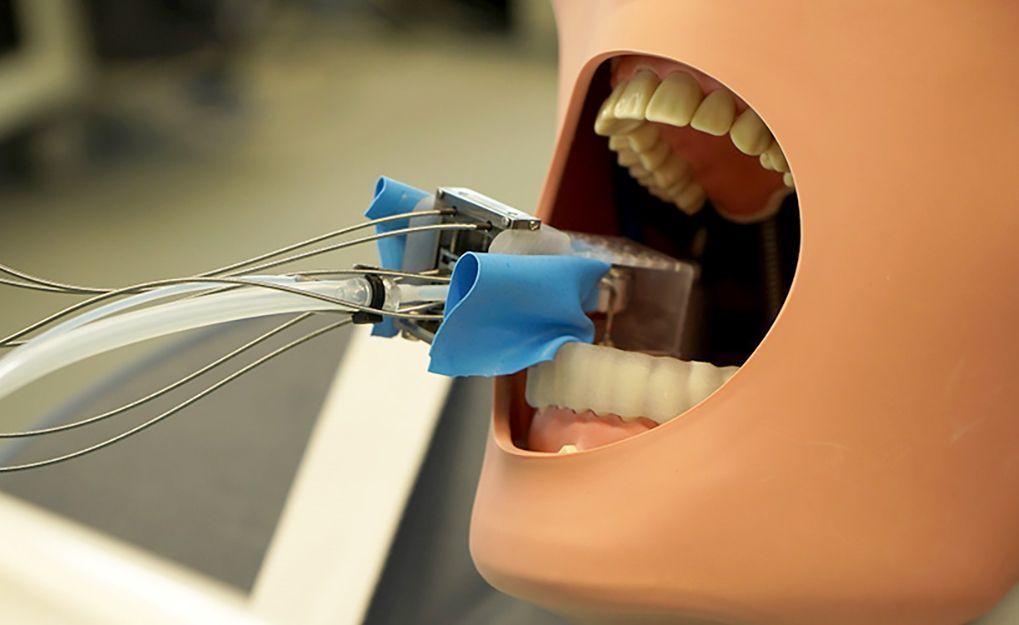 Robô miniatura prepara dentes para coroas em consulta odontológica única