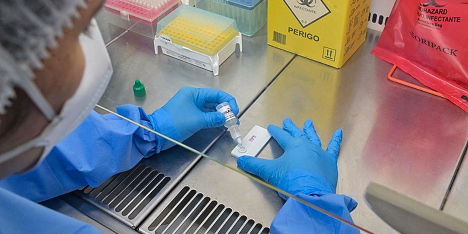 Anvisa impõe novas regras para laboratórios de controle de qualidade