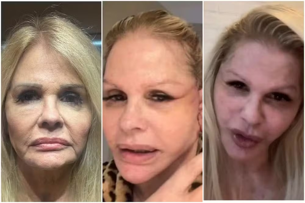 Monique Evans mostra rosto sem maquiagem e celebra recuperação