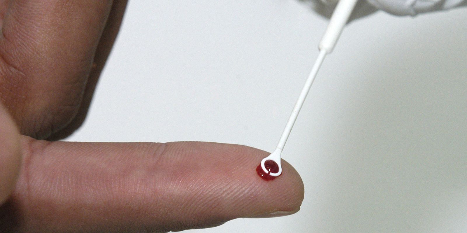 Fiji decreta emergência nacional após aumento acelerado de casos de HIV