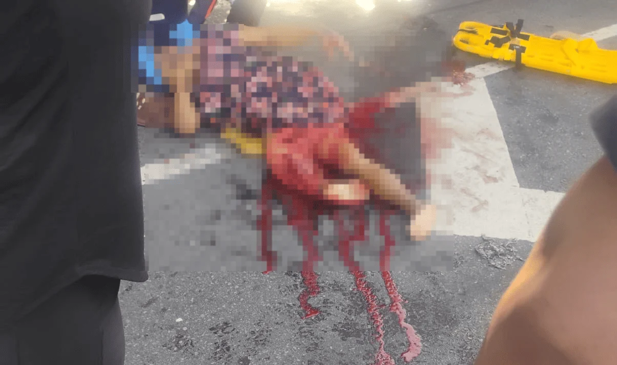 Mulher sofre lesão severa após ser atingida por caminhão em Aracaju